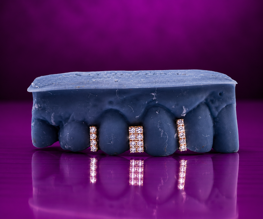 Lab-Grown Diamond Gap Fillers