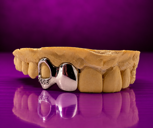 Iced Open Face & Solid Grillz – 925 Sterling Silver