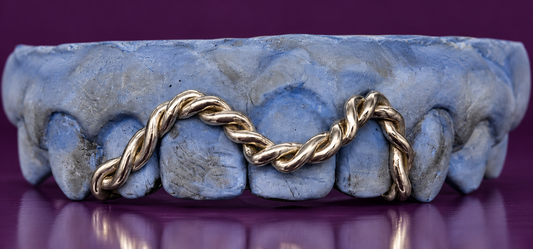 INFINITY ROPE GRILLZ — Twisted Gold Edition